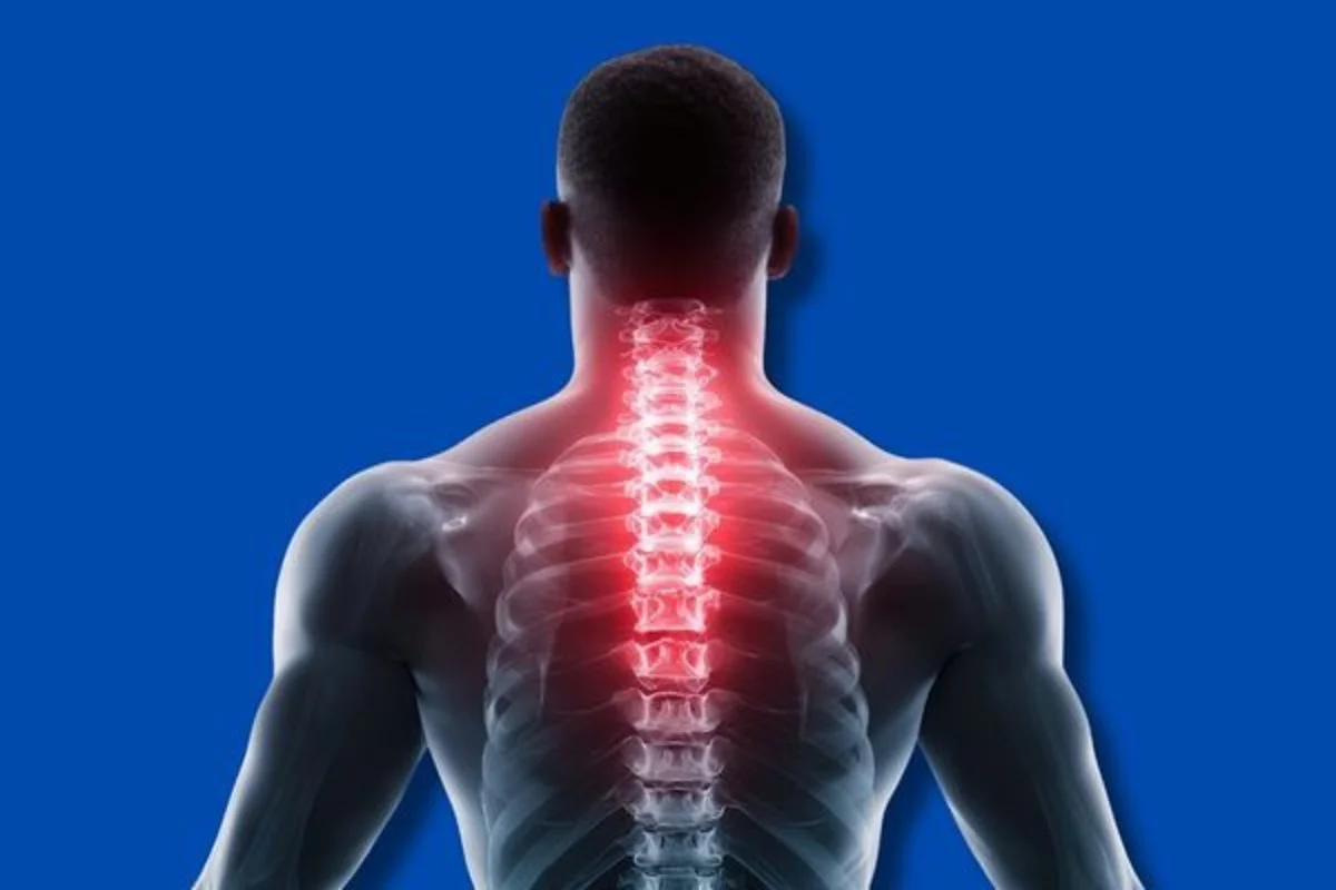 Boyun Düzleşmesi Nedir? Belirtileri ve Etkili Tedavi Yöntemleri