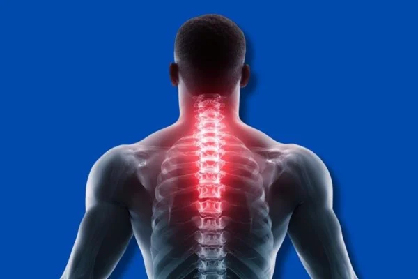 Boyun Düzleşmesi Nedir? Belirtileri ve Etkili Tedavi Yöntemleri