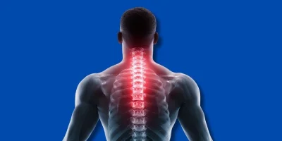 Boyun Düzleşmesi Nedir? Belirtileri ve Etkili Tedavi Yöntemleri